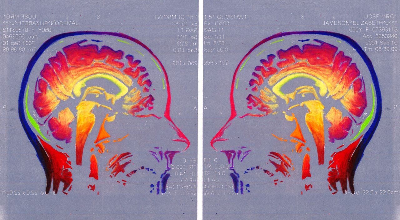 "Face Off," sagittal MRI views of the artist's brain.