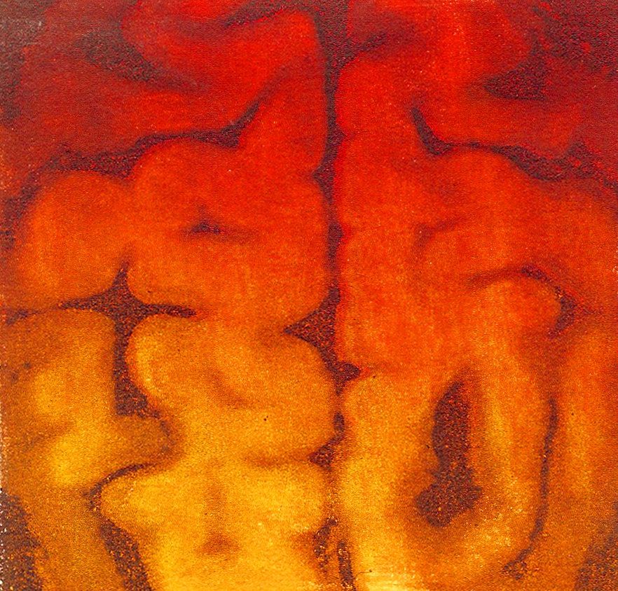 "Intrigue," an axial MRI view of the artist's cerebellum.