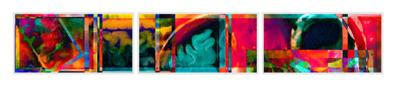 "Kaleidoscope," axial, coronal, and sagittal views of the artist's brain.