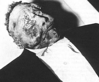 <em>Body of 14-year-old Emmett Till as it lay in the funeral home. Despite pleas from the funeral director, Mamie Till Bradley — Till’s mother — insisted on having an open-casket funeral; so the world could see what happened to her son</em>.