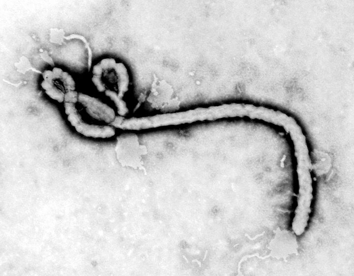 A study of Ebola survivors in Liberia has revealed that the virus can stay in some men's semen for over a year. 