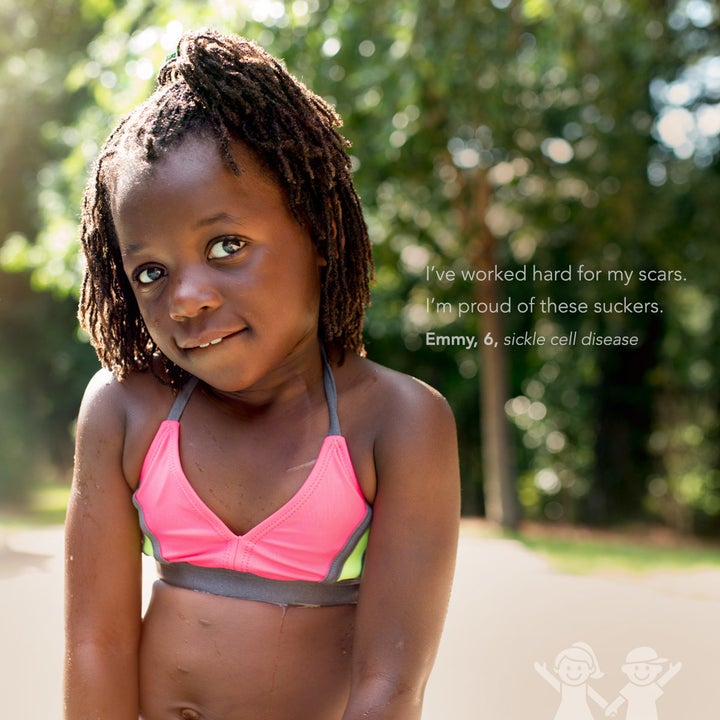 This photo series features 11 inspiring kids showing off their scars like badges of honor.