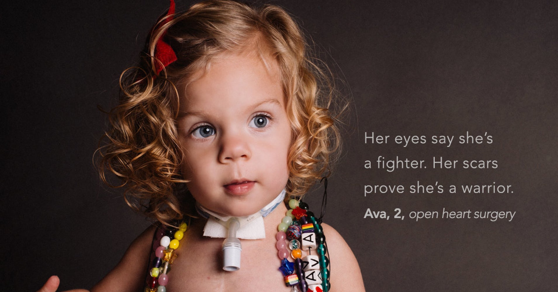 Kids Proudly Show Off Their Scars In Inspiring Photo Series HuffPost