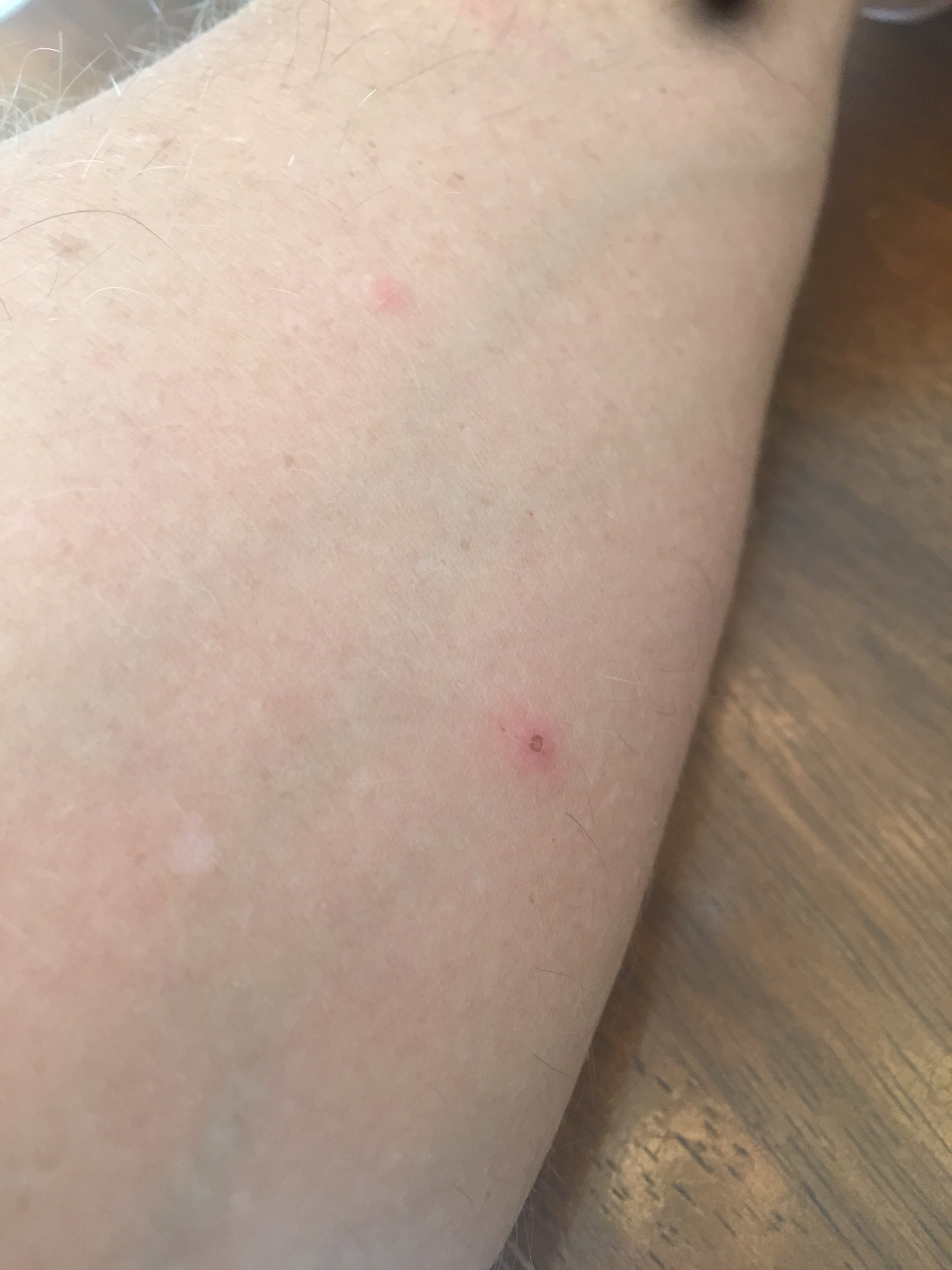 Update more than 123 chiggers nail polish super hot songngunhatanh.edu.vn