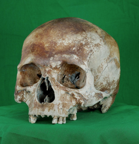 <strong>The skull of the ship's carpenter. <a href="https://sketchfab.com/models/4b1ad3107de049f6af2c6d77f0113b56#embed" target="_blank" role="link" class=" js-entry-link cet-external-link" data-vars-item-name="View a 3D model of his skull here " data-vars-item-type="text" data-vars-unit-name="57cd4322e4b085cf1ecebe07" data-vars-unit-type="buzz_body" data-vars-target-content-id="https://sketchfab.com/models/4b1ad3107de049f6af2c6d77f0113b56#embed" data-vars-target-content-type="url" data-vars-type="web_external_link">View a 3D model of his skull here </a> or below via Sketchfab</strong>