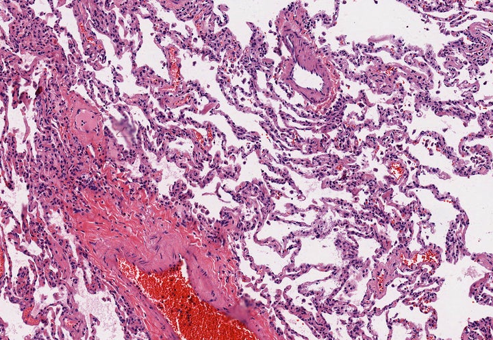 Cross section of the lung tissue in the microscopic view. 