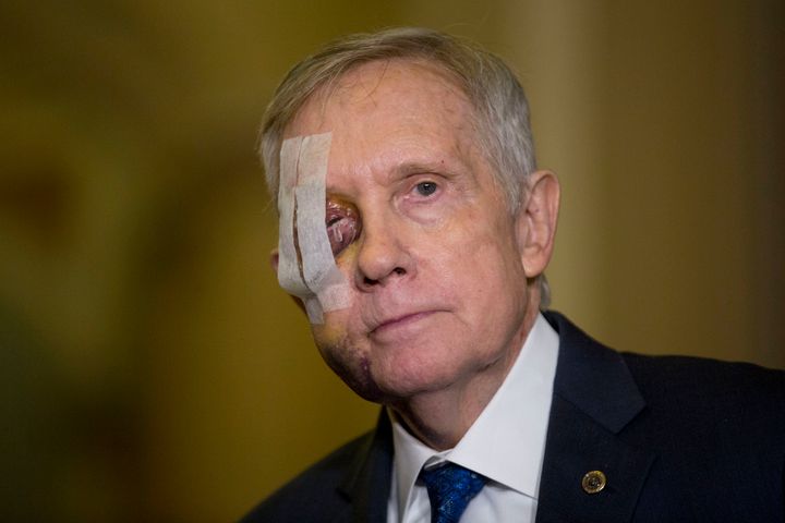 Senate Minority Leader Harry Reid (D-Nev.) injured his eye in an exercising accident.