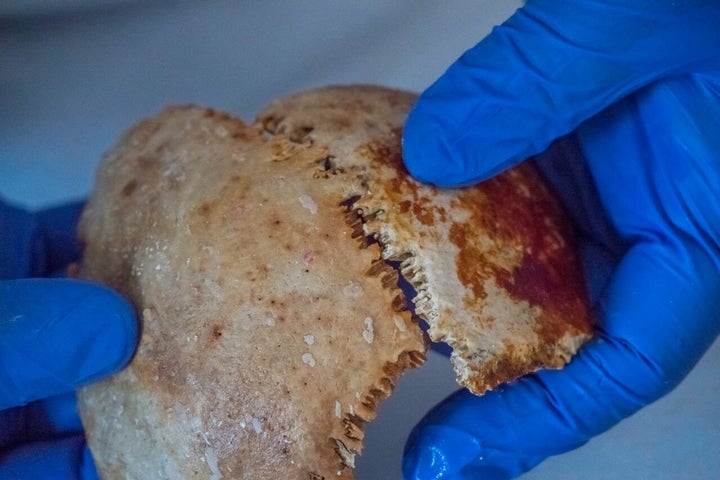 The team conducting research on the wreck found a nearly intact skull.