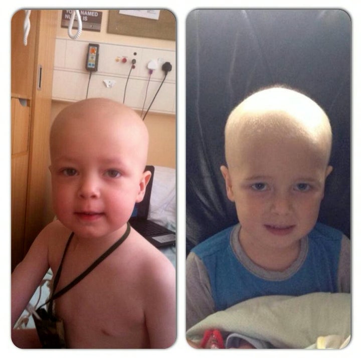 Logan left, Regan, right, during chemotherapy.