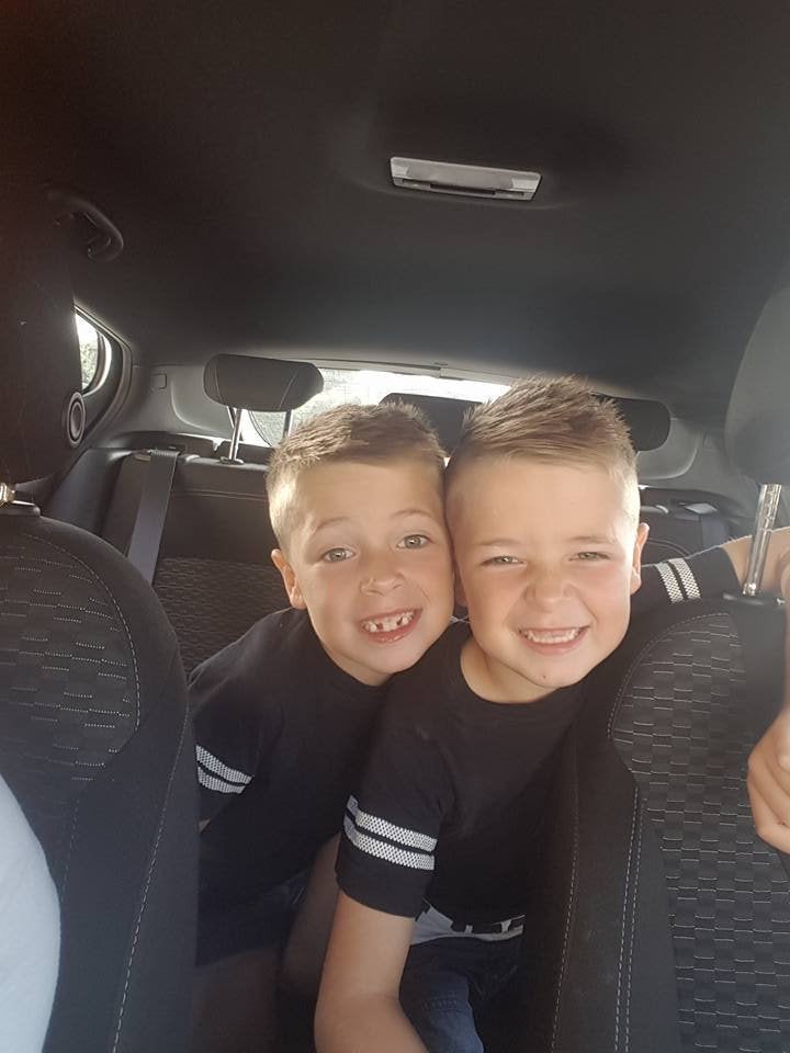 (L-R) Logan and Regan Skinner after their treatment.