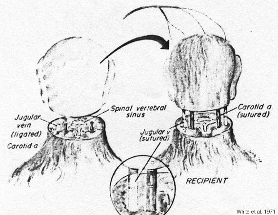 In 1971 a Dr Robert White transplanted the head of one monkey onto the body of another