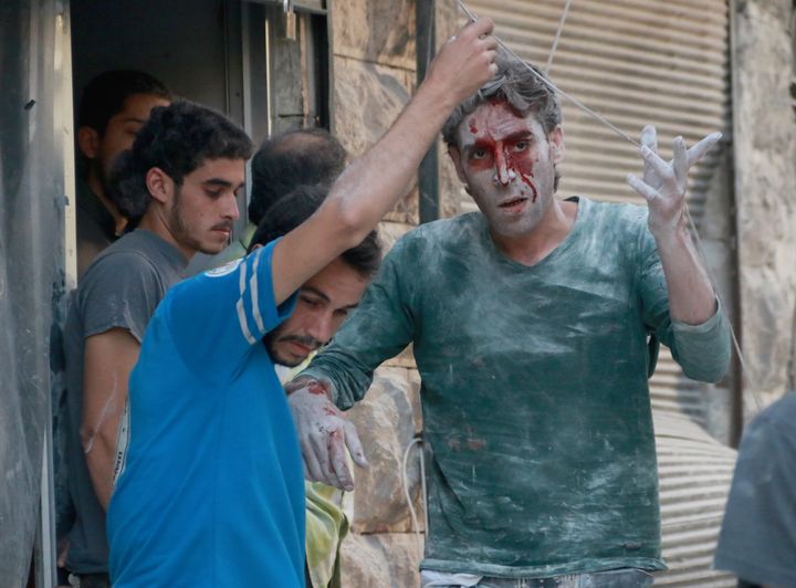 A wounded man is seen after airstrikes near Aleppo, Syria on Tuesday.