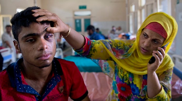 A local boy hit by pellets in his eye.