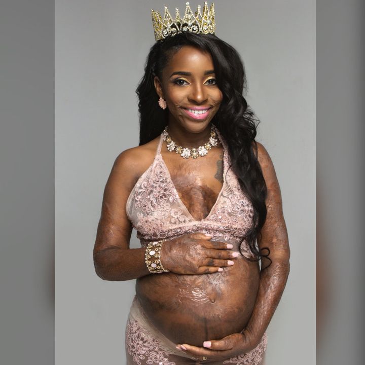 Andrea Grant said India Arie's song "Video" inspired her queen-themed maternity photos.