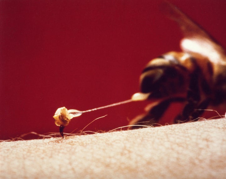 A honeybee leaves its stinger in a victim’s arm. This photograph is courtesy of the book <i>The Sting of the Wild.