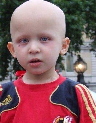 Leo in the midst of treatment - Aug 2008