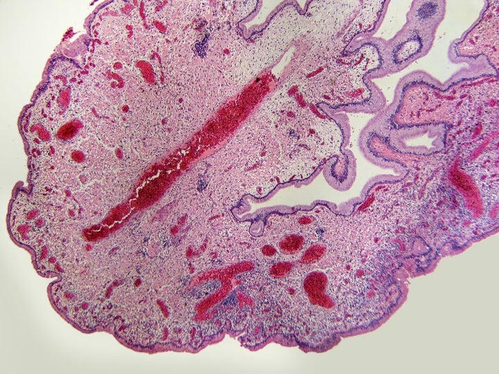 A cellular view of the uterine lining during a pregnancy, which forms the maternal side of the placenta