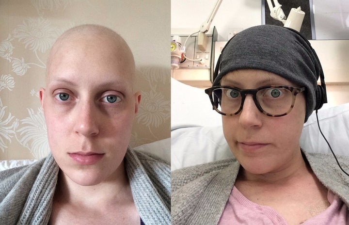 Emma during chemotherapy.