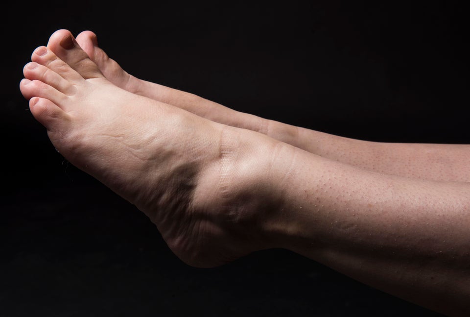 These Honest Images Show How Women Really Feel About Their Feet 