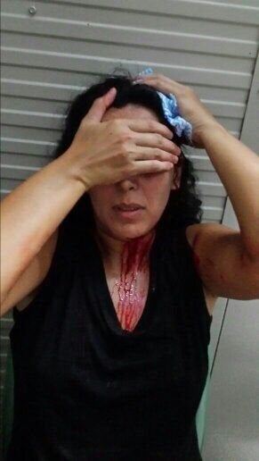 A refugee who was attacked by Nauruan locals.