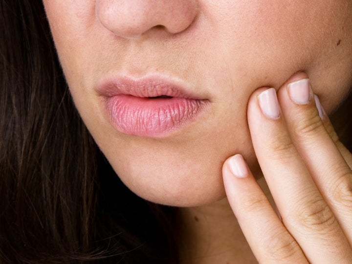 What Are Canker Sores And How Do You Get Rid Of Them? | HuffPost Life