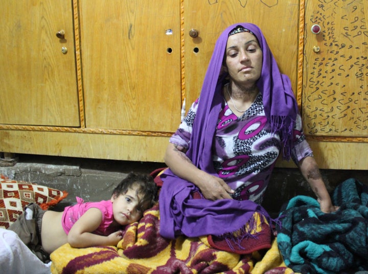 Zeynep sits with one of her daughters seven months after the chemical weapons attack on her town. She still suffers from disfiguring scars and burns.