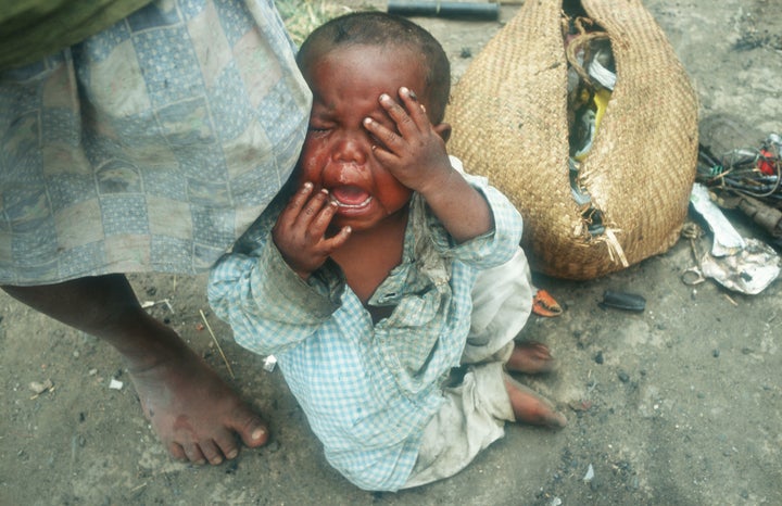 Madagascar has struggled with drought and malnutrition for years. But climate change has exacerbated extreme weather in the region and, in turn, food insecurity.