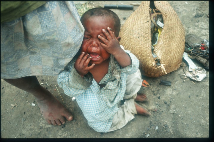 Madagascar has struggled with drought and malnutrition for years. But climate change has exacerbated extreme weather in the region and, in turn, food insecurity. 