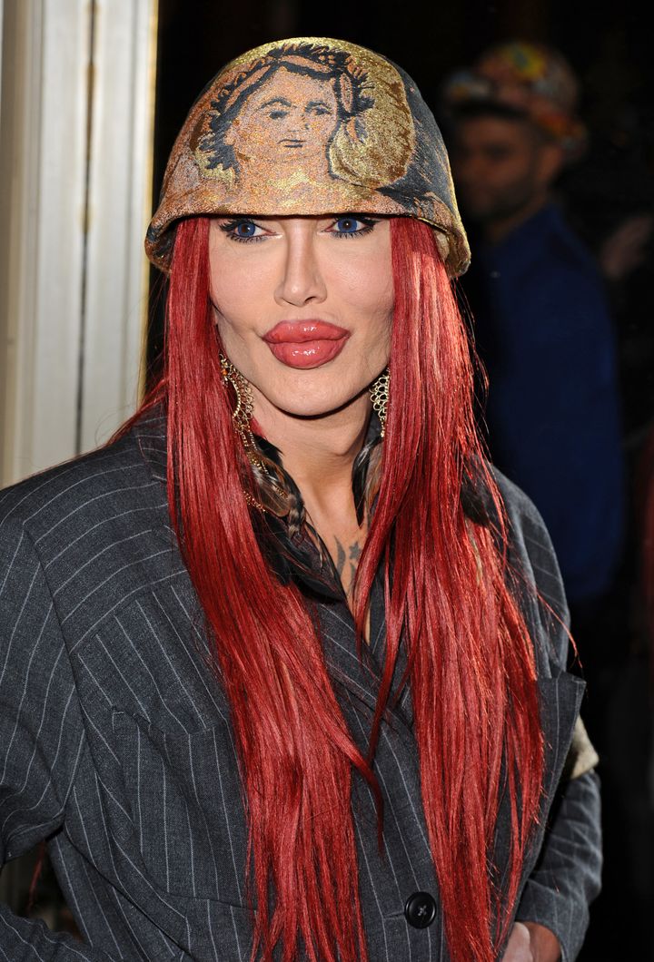 <strong> The late Pete Burns</strong>