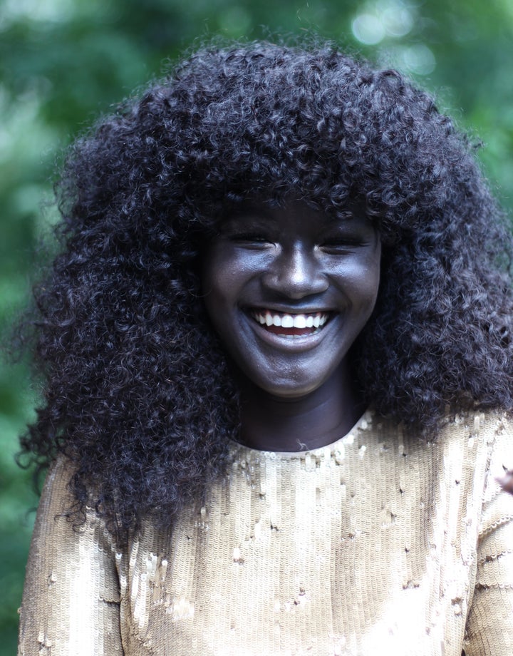 This Girl Was Bullied For Her Skin Color Now Shes A Badass Model 