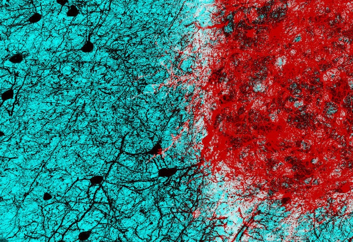 Embryonic neurons (shown in red) transplanted into the adult mouse brain connect with host neurons (shown in black), rebuilding neural circuits previously lost due to an injury.