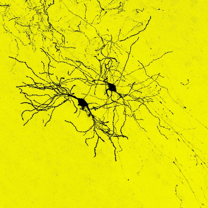 Transplanted cells formed long-range connections with thalamic cells (shown in black).