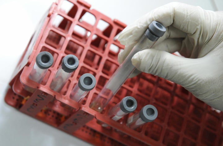 A government medical technologist conducts free HIV screening test on blood serum samples from clients at the social hygiene clinic of the Manila Health Department on November 28, 2008. (ROMEO GACAD/AFP/Getty Images)