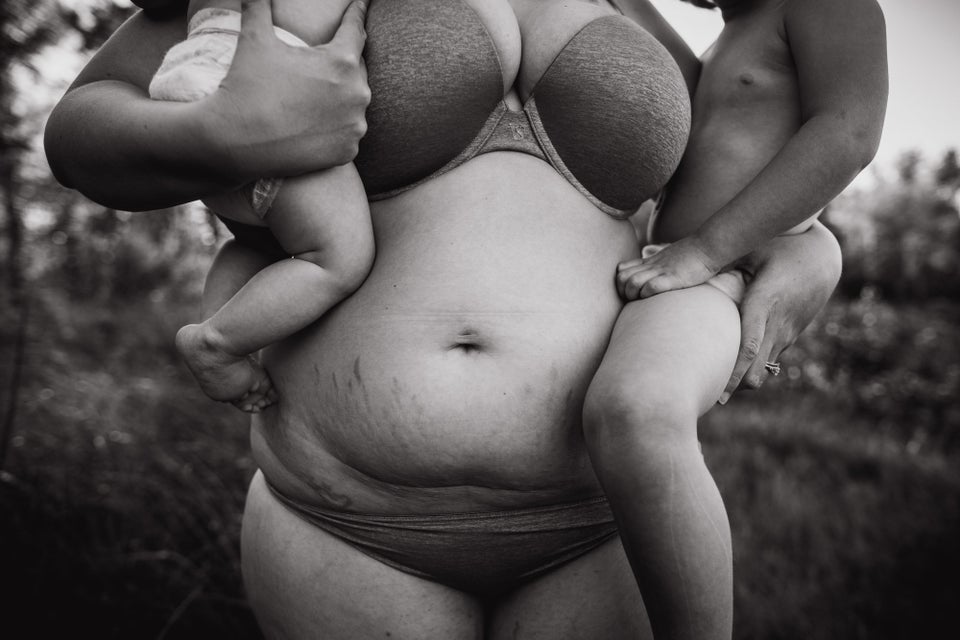 11 Photos That Capture the Beauty of Postpartum Bodies