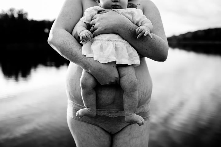 Raw, Real Photos of Women's Postpartum Bodies Celebrate the Beauty