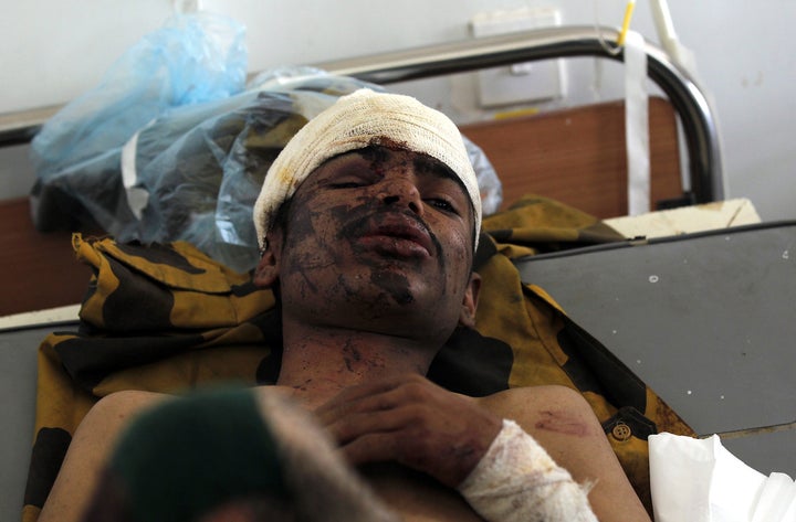 A Yemeni man who was wounded in an airstrike in Sanaa, Yemen, the previous day lies on a hospital bed on Oct. 9, 2016.