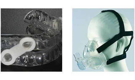 Left: An oral appliance used to treat sleep apnea (worn inside the mouth); Right: a CPAP mask