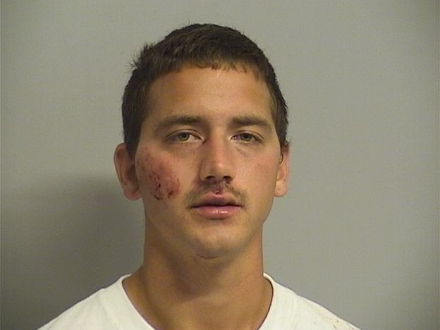 John Pinney, 25, appeared bruised after his arrest Monday night. He faces a long list of charges.