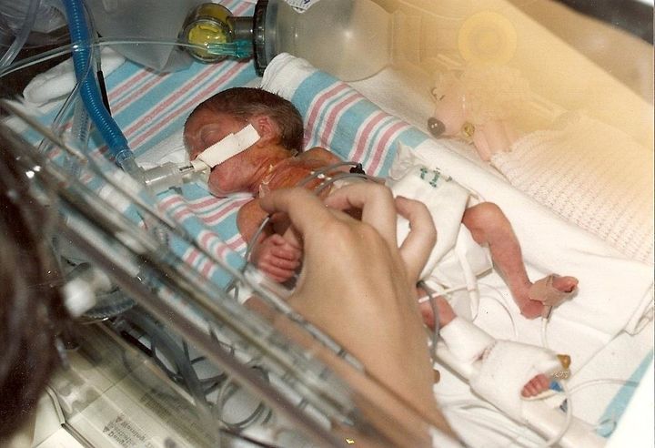I was born 1 pound, 12 ounces and spent three months in the NICU.