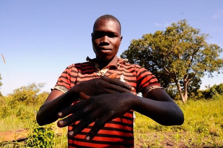 Michael Inyani, 30, says he was beaten with sticks and slammed in the chest with guns after being mistaken for a rebel in South Sudan.