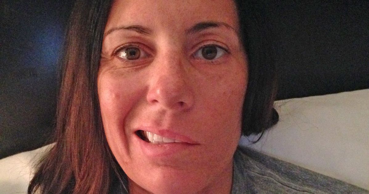 Woman Whose Face Was Partially Paralysed Smiles Again Thanks To Surgery Huffpost Uk Life