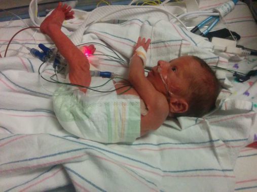 A preemie diaper went up to his armpits