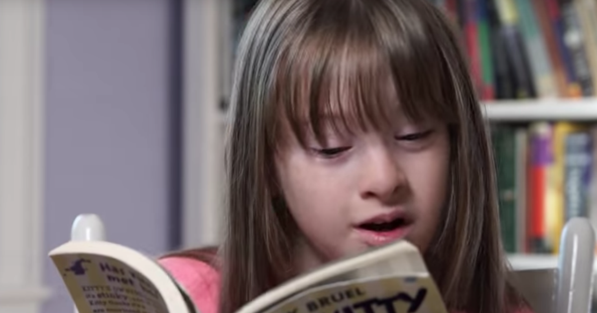 People With Down's Syndrome Answer The Most Googled Questions About The