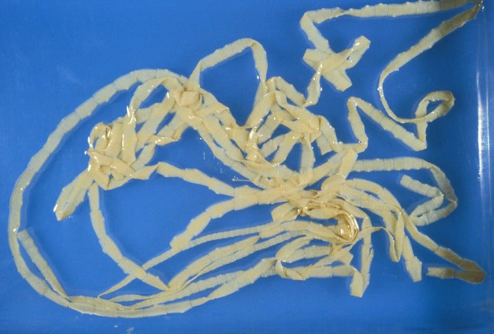 Beef tapeworm (Taenia saginata), a parasite of both cattle and humans, where it causes the disease taeniasis. This specimen was 10 meters long when untangled.