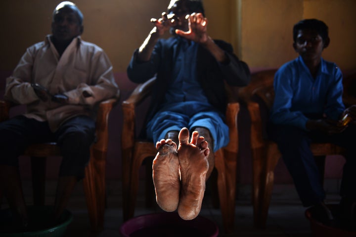 A cured leprosy patient shows his disfigured feet and hands in a leprosy colony in New Delhi, on March 11, 2015. The last decade has seen a resurgence of leprosy in India, which accounts for more than half of the 200,000 new cases worldwide each year.