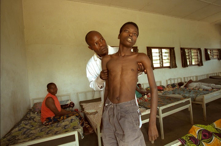 Sleeping sickness patients have a characteristic gaze: expressionless and fixed. They also typically have a slow, shuffling g
