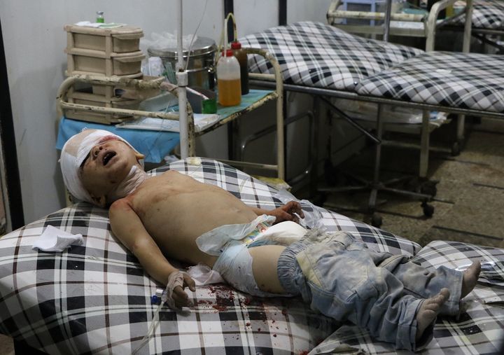 A wounded toddler waits to receive medical treatment following an airstrike over the civilian populated residential areas.