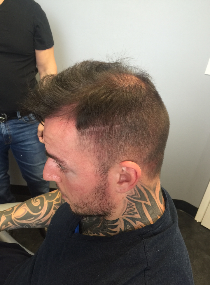 <p>Erick Laurino before picture </p>