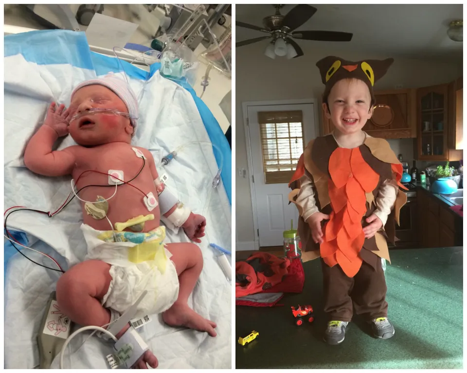Photos Of Premature Babies Then And Now Show Their Incredible Journey Huffpost Life
