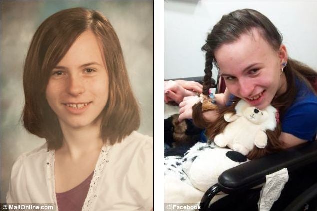 Speedy deterioration: Justina Pelletier pictured left in 2012, before going to Boston Children’s Hospital, and right, during her treatment there 